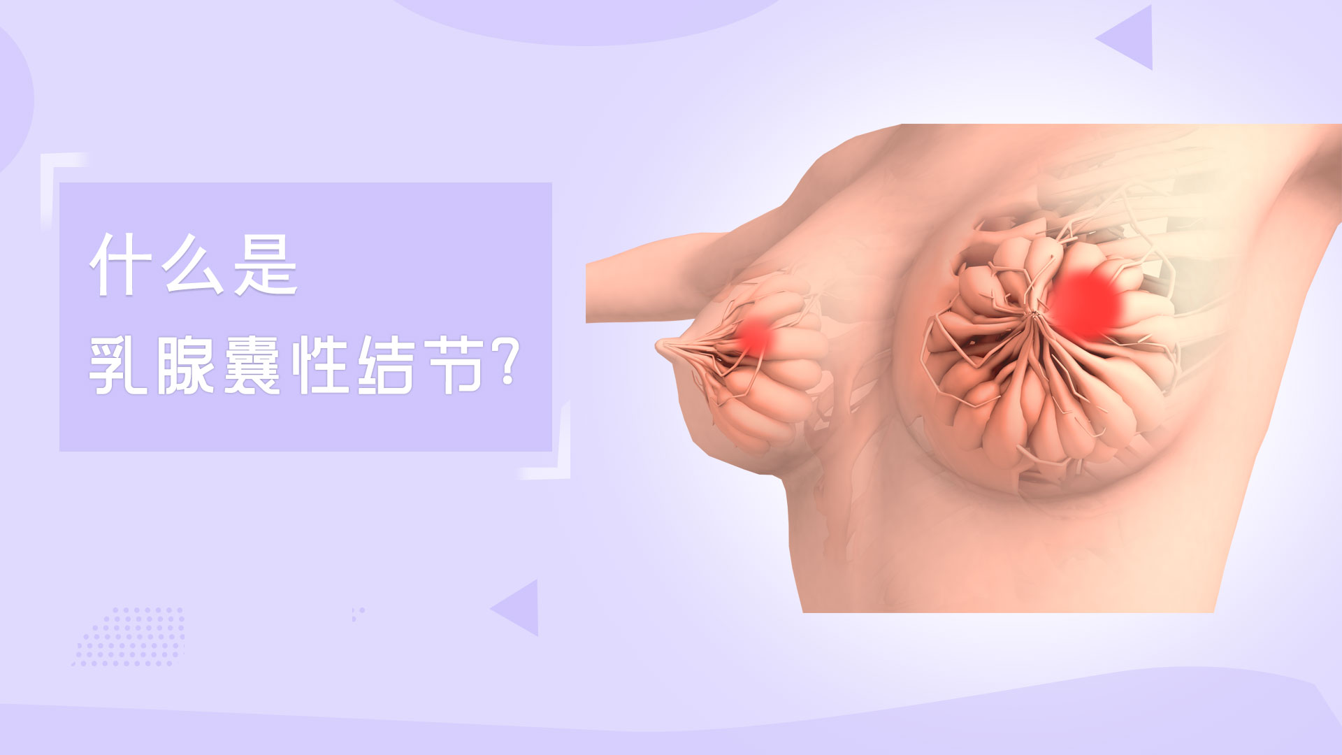 什么是乳腺囊性结节