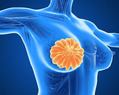 粉红120乳腺健康：乳房胀痛是乳腺癌的前兆吗？